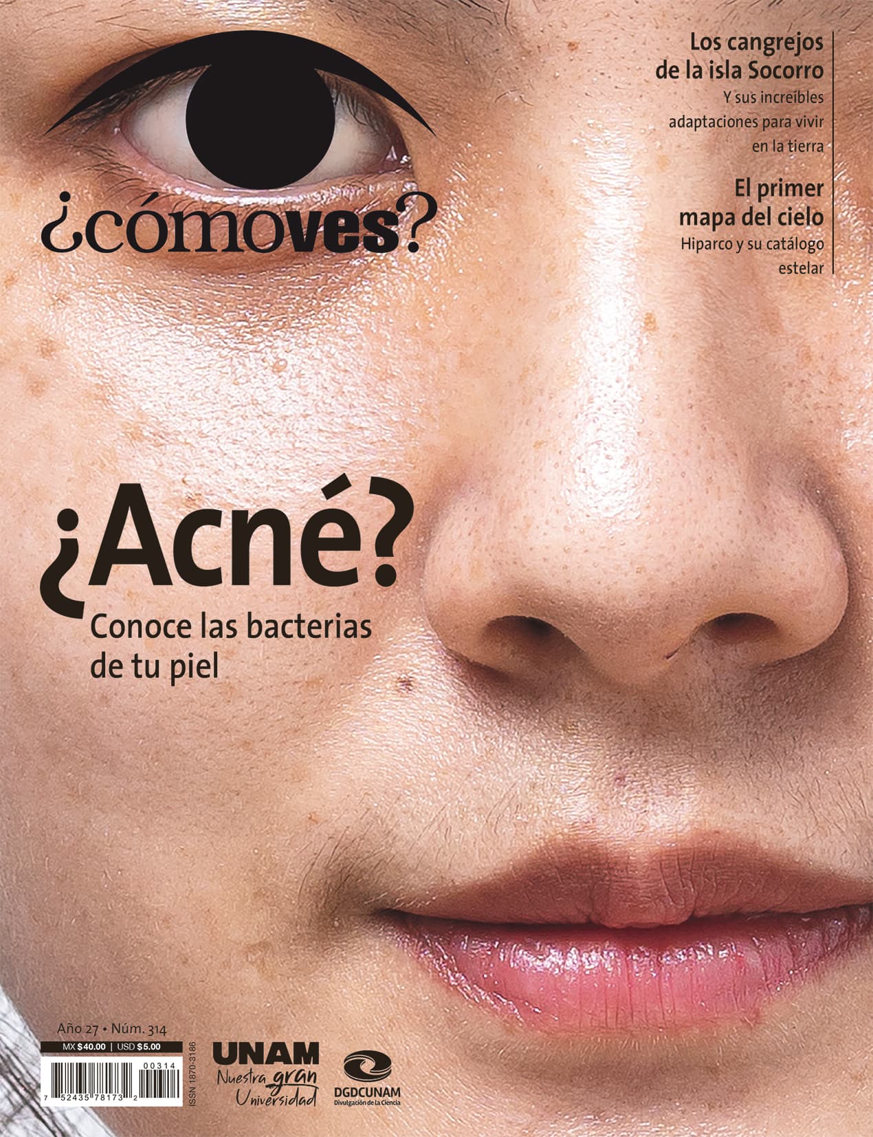 REVISTA ¿CÓMO VES? NÚMERO 314. ¿ACNÉ? CONOCE LAS BACTERIAS DE TU PIEL
